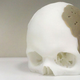 Illustration for article titled Dude Has 75 Percent of His Skull Replaced By 3D-Printed Replica